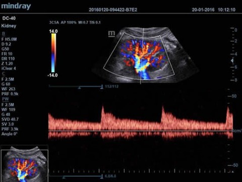Аппарат ультразвуковой диагностический DC-40 - 388 500 руб.
