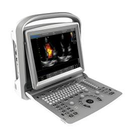 УЗИ аппарат Chison SonoTouch 50 (ECO 6)