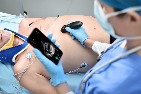 УЗИ сканер Mindray TE Air i3P - 329 800 руб.