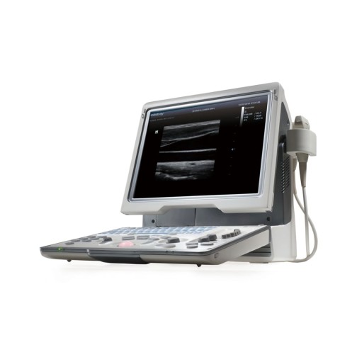 УЗИ аппарат Mindray DP-50 Color - 341 100 руб.
